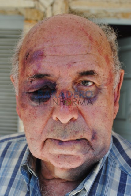«Esto no tiene más arreglo, es una vergüenza lo que está pasando»