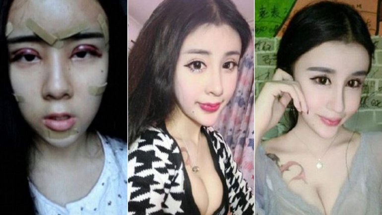 Las inquietantes cirugías de esta niña fascinan a los chinos