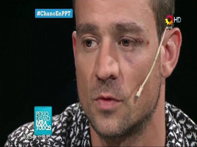 Chano Moreno Charpentier de Tan Biónica habló con Jorge Lanata