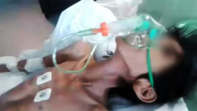 Murió adolescente qom por desnutrición en Chaco