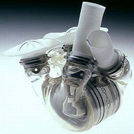 El Hospital Garrahan presenta prototipo de corazón artificial fabricado en el país