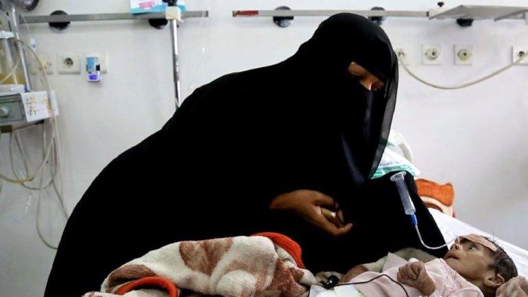 La foto que indigna al mundo: Udai Faisal, el niño símbolo de la guerra olvidada de Yemen