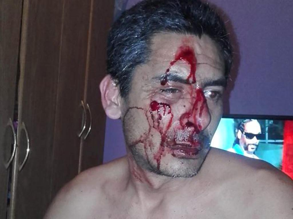 San Pedro. Agresión mutua entre inspectores de tránsito y conductor de un auto