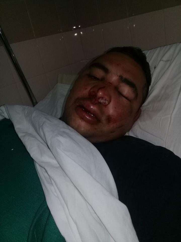 Lo golpearon para robarle el celular