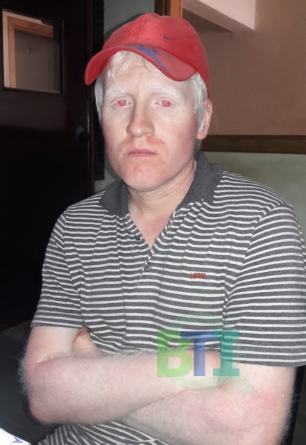 «Me puso un revolver en el cuello y me dijo dame todo porque te quemo»