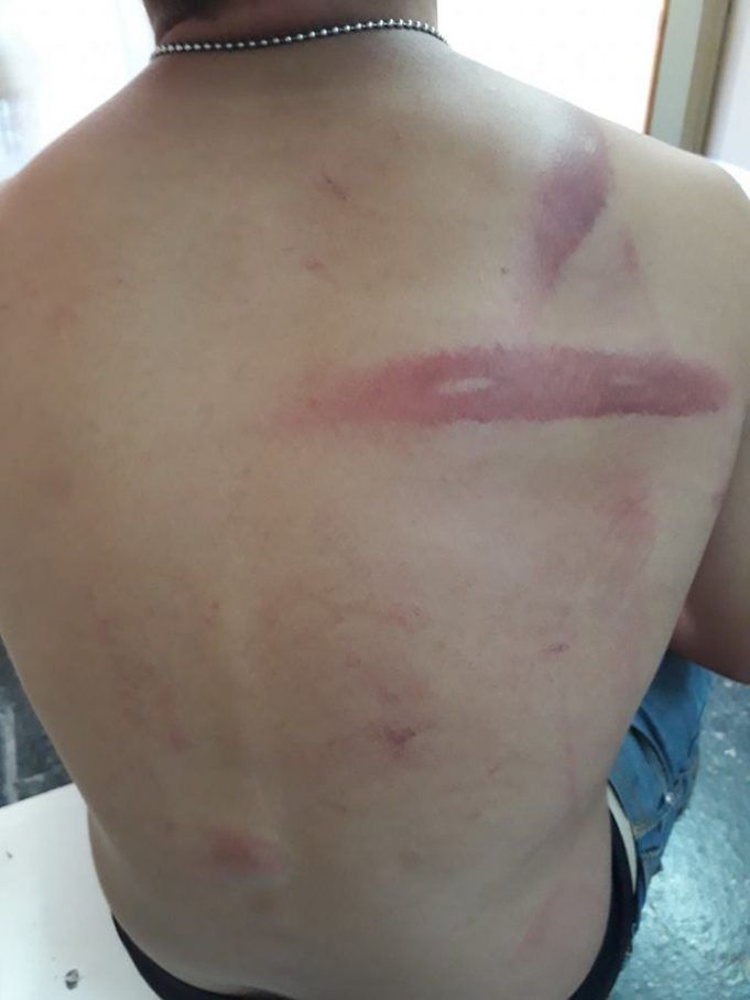 Mujer denunció que personal policial golpeó por error a su hijo de 16 años