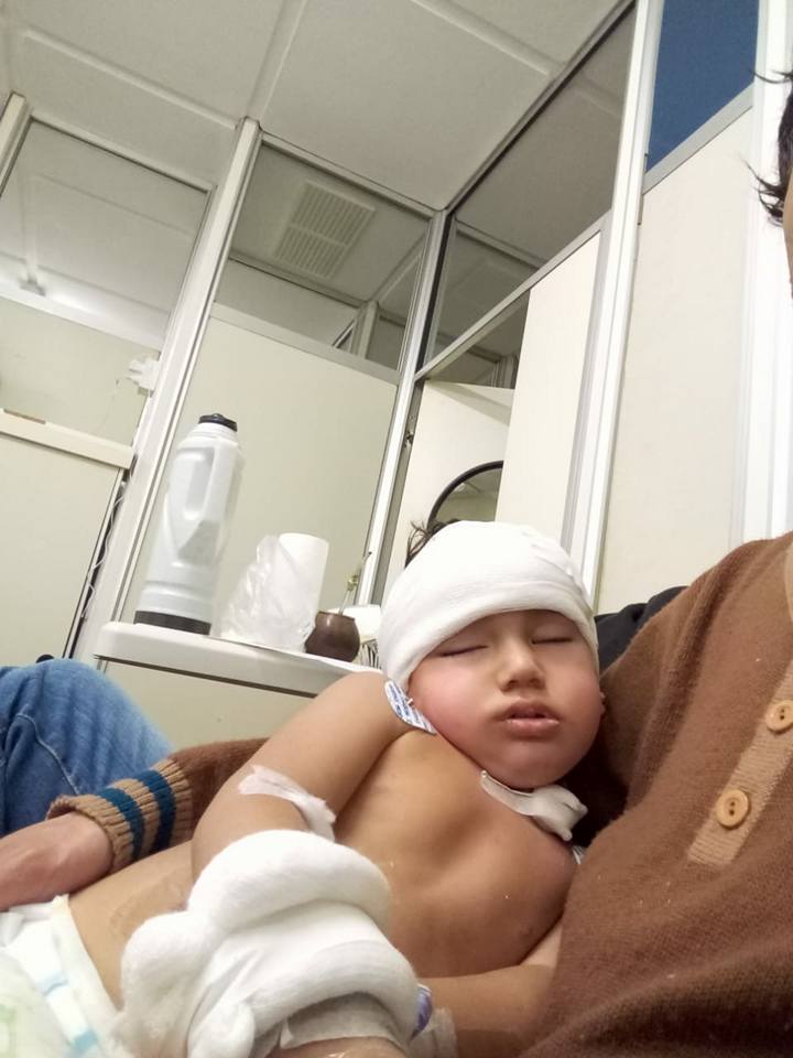 Nicolás fue intervenido con éxito