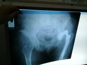 Por Facebook una joven denuncia mala praxis en el hospital