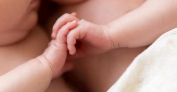 Inédito: separaron con éxito a bebés siameses en Argentina