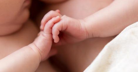 Inédito: separaron con éxito a bebés siameses en Argentina