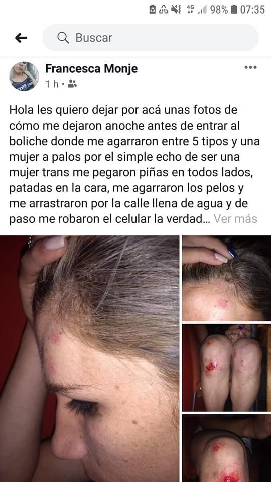 En la madrugada: Agreden a una chica trans en la vía pública