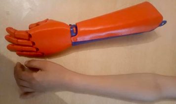 Prótesis 3D: Se construyó una en el Club Social de Innovación