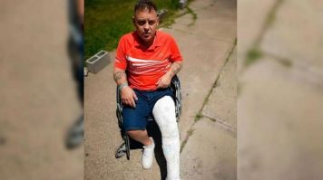 «El Pepo» fue operado con éxito de la fractura de peroné en su pierna izquierda