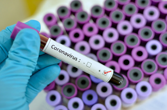 San Pedro: La esposa del Secretario de Hacienda tiene coronavirus: viajaron juntos a Italia