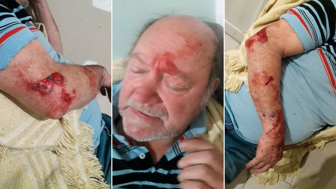 La palabra del jubilado que mató a un ladrón: “Me siento mal, yo no nací para matar a nadie”