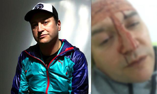 Leo García denunció que fue víctima de un ataque homofóbico en un bar