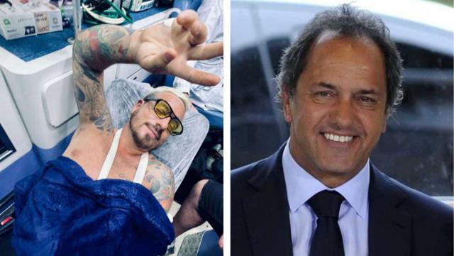 Daniel Scioli le hizo una broma a Fede Bal tras su accidente: “A vos te salió mejor que a mí”
