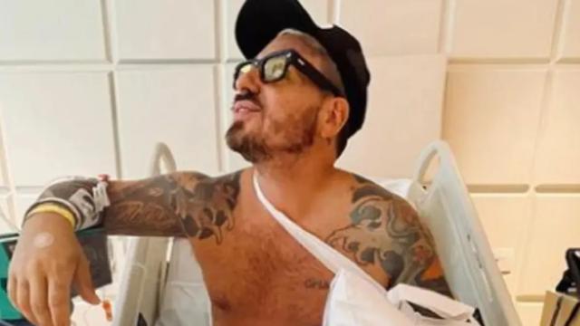 Fede Bal lloró al relatar su accidente: “Podría haber perdido el brazo, se salían todos los huesos”