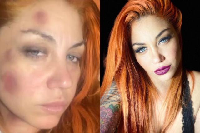 Lourdes de Bandana denunció haber sufrido violencia de género y mostró su cara golpeada