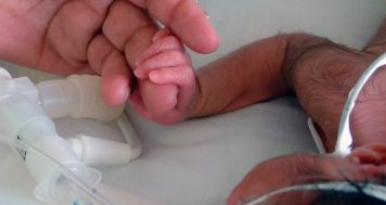 Se registró el nacimiento de una bebé con cola de casi 6 centímetros de largo en el norte de México