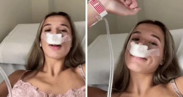 “Para que mis hijos nazcan con linda nariz”: se sometió a una rinoplastia y en las redes no la perdonaron