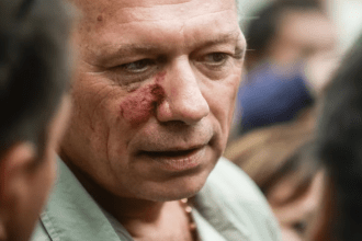 Berni aseguró que fue agredido por una patota y se comparó con Fernando Báez Sosa