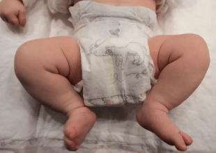 Nacieron las primeras dos bebés concebidas por un robot