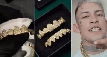 L-Gante mostró su nueva dentadura postiza con detalles de oro e incrustaciones de diamante