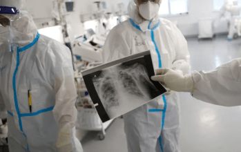 Brote de neumonía en China: cuáles son los distintos tipos de infección pulmonar y sus síntomas