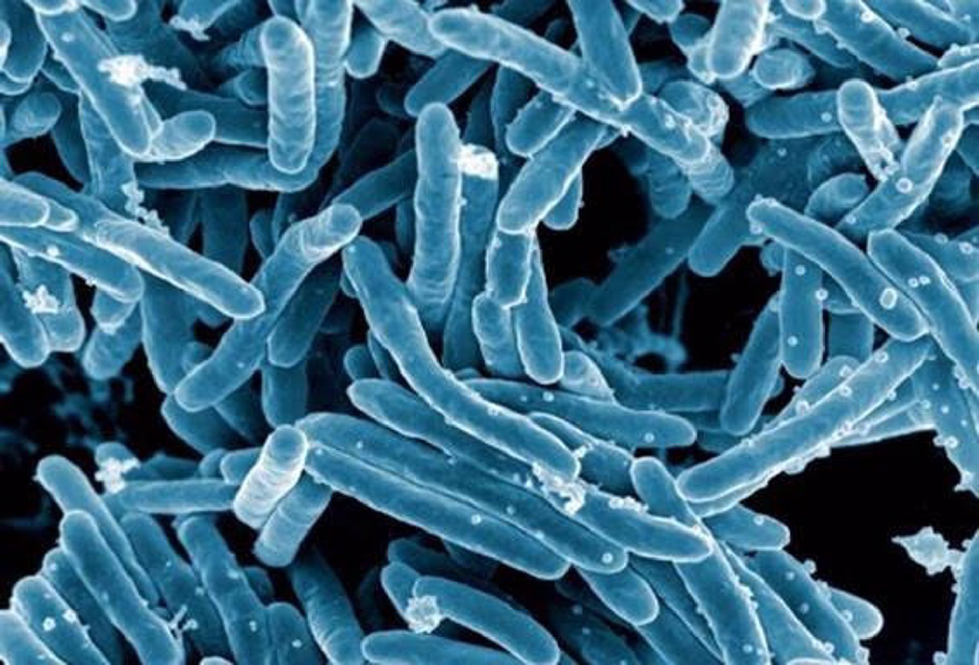 Cada 8 horas muere una persona en Argentina de tuberculosis